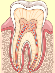 gum disease
